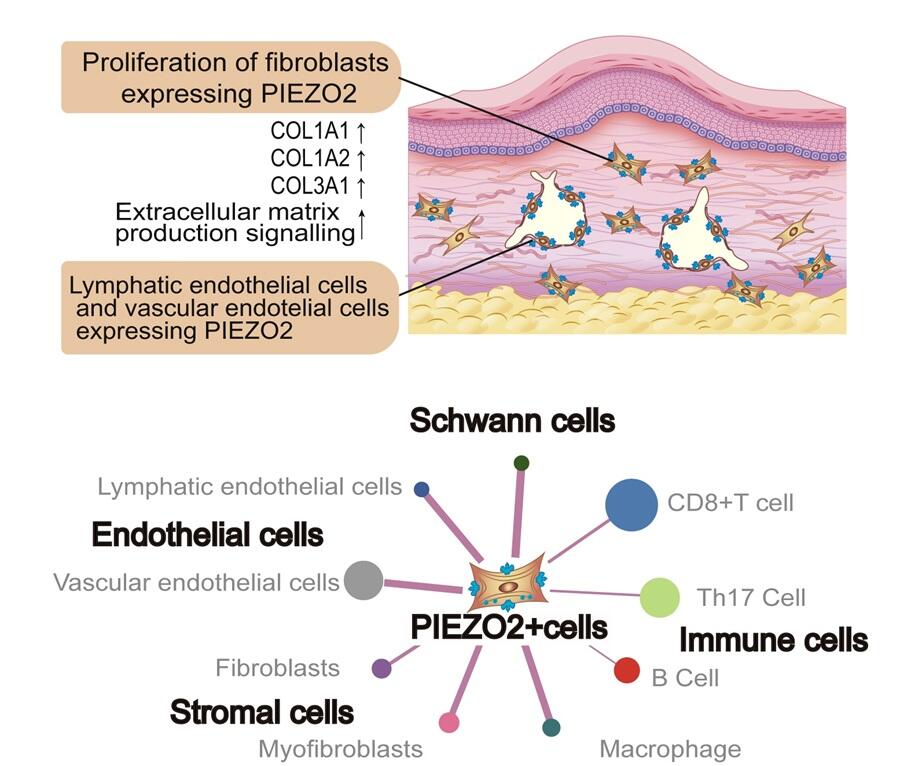 Pathological Mechanism of Mechanosensitive Cells Driving the Growth of Keloids, Yuzuru IKEHARA, Professor, Graduate School of Medicine